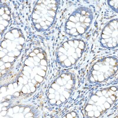 Immunohistochemistry-Paraffin: FAM3A Antibody - Azide and BSA Free [NBP3-16063]