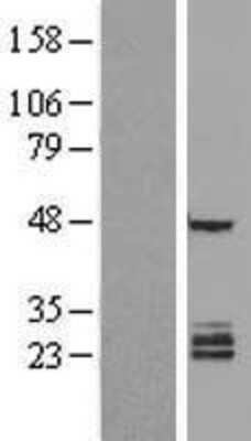 Western Blot: FAM3B Overexpression Lysate [NBL1-10522]