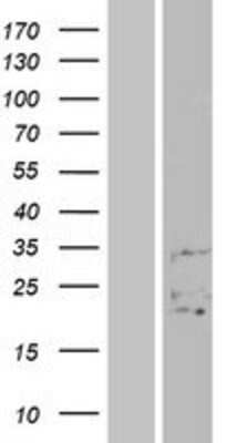 Western Blot: FAM3B Overexpression Lysate [NBP2-04455]