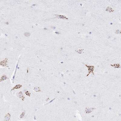 Immunohistochemistry-Paraffin: FAM3C Antibody [NBP2-13996]