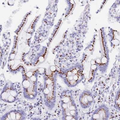 Immunohistochemistry-Paraffin: FAM3C Antibody [NBP2-13996]