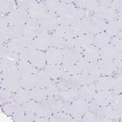 Immunohistochemistry-Paraffin: FAM3C Antibody [NBP2-13996]