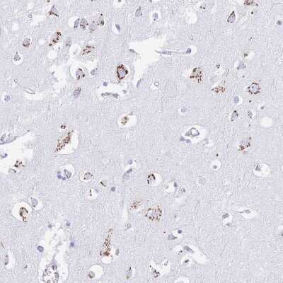 Immunohistochemistry-Paraffin: FAM3C Antibody [NBP2-13996]