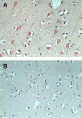Immunohistochemistry-Paraffin: FAM3C Antibody [NBP2-24464]