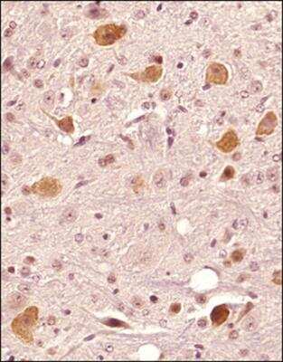 Immunohistochemistry-Paraffin: FAM3C Antibody [NBP2-24464]