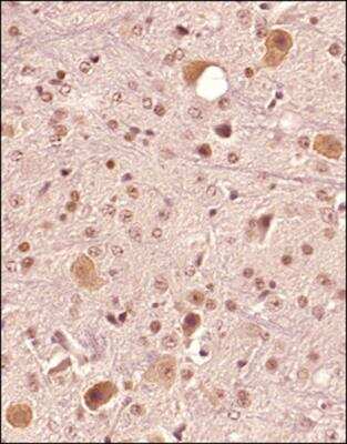 Immunohistochemistry-Paraffin: FAM3C Antibody [NBP2-24464]