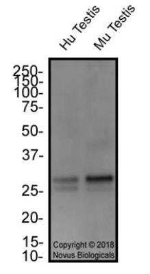 Western Blot: FAM3C Antibody [NBP2-24464]