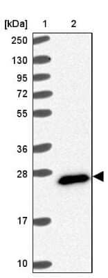 Western Blot: FAM3C Antibody [NBP2-13996]