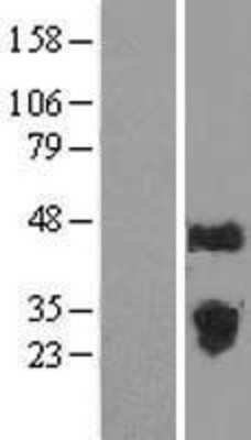 Western Blot: FAM3C Overexpression Lysate [NBL1-10524]