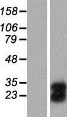 Western Blot: FAM3C Overexpression Lysate [NBP2-09209]