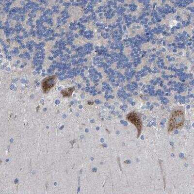 Immunohistochemistry-Paraffin: FAM40B Antibody [NBP1-81435]