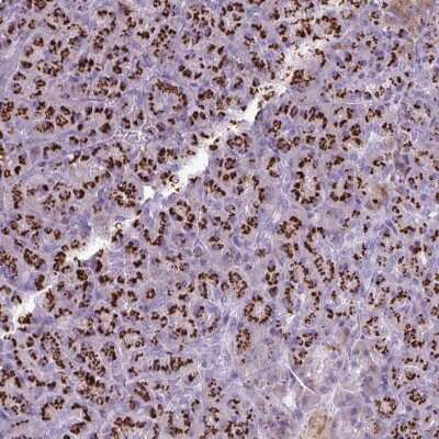 Immunohistochemistry-Paraffin: FAM43A Antibody [NBP2-31914]