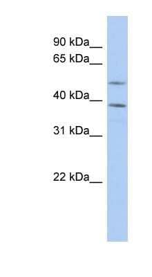 Western Blot: FAM46A Antibody [NBP1-55488]