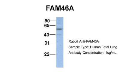 Western Blot: FAM46A Antibody [NBP1-55488]