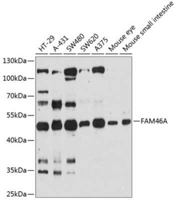 Western Blot: FAM46A AntibodyAzide and BSA Free [NBP3-04800]