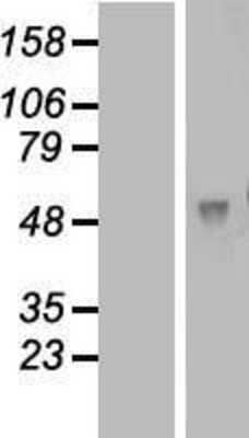 Western Blot: FAM46A Overexpression Lysate [NBL1-10530]