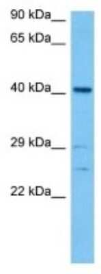 Western Blot: FAM46B Antibody [NBP3-10190]