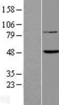 Western Blot: FAM46B Overexpression Lysate [NBL1-10531]