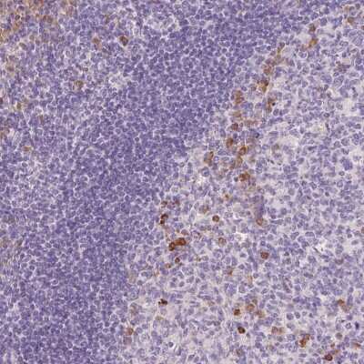 Immunohistochemistry-Paraffin: FAM46C Antibody [NBP2-30564]