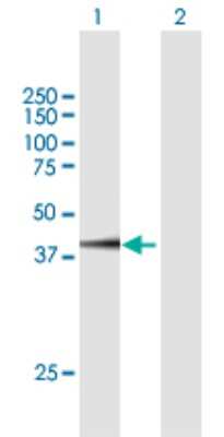 Western Blot: FAM46C Antibody [H00054855-B01P]