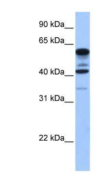 Western Blot: FAM46C Antibody [NBP1-57697]