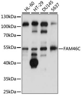 Western Blot: FAM46C AntibodyAzide and BSA Free [NBP3-04409]