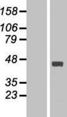 Western Blot: FAM46C Overexpression Lysate [NBP2-06943]