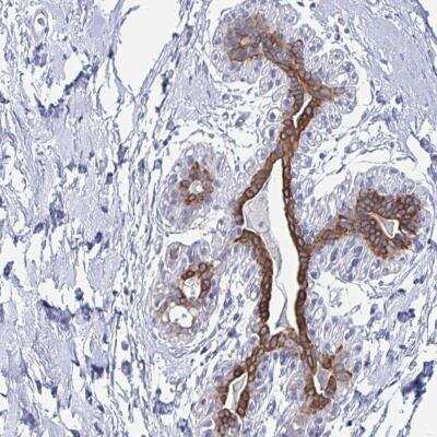 Immunohistochemistry-Paraffin: FAM46D Antibody [NBP2-32454]