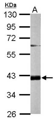 Western Blot: FAM46D Antibody [NBP2-16417]