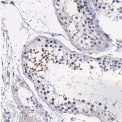 Immunohistochemistry-Paraffin: FAM47A Antibody [NBP1-82719]