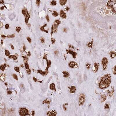 Immunohistochemistry-Paraffin: FAM47B Antibody [NBP2-13998]