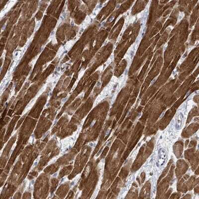 Immunohistochemistry-Paraffin: FAM47B Antibody [NBP2-13999]