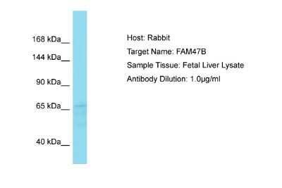 Western Blot: FAM47B Antibody [NBP2-87420]