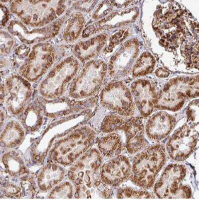 Immunohistochemistry: FAM47E Antibody [NBP2-30745]