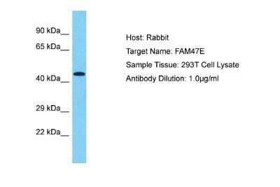 Western Blot: FAM47E Antibody [NBP2-82694]