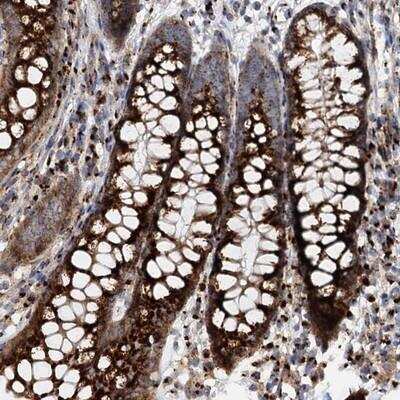 Immunohistochemistry: FAM48A Antibody [NBP1-90795]