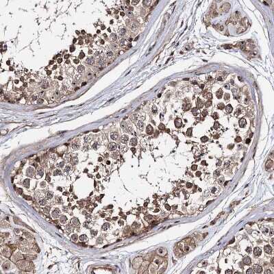 Immunohistochemistry-Paraffin: FAM48A Antibody [NBP1-90794]