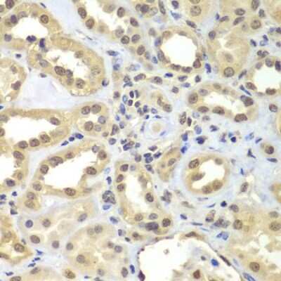 Immunohistochemistry-Paraffin: FAM48A Antibody - BSA Free [NBP3-03767]