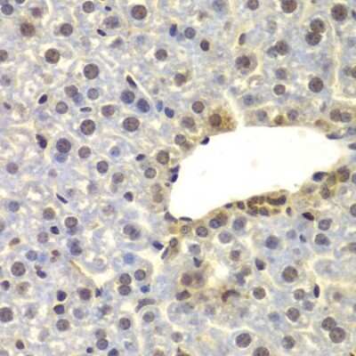 Immunohistochemistry-Paraffin: FAM48A Antibody - BSA Free [NBP3-03767]