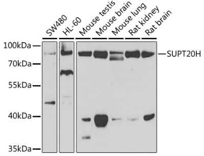 Western Blot: FAM48A AntibodyBSA Free [NBP3-03767]