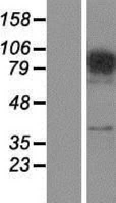 Western Blot: FAM48A Overexpression Lysate [NBP2-08734]