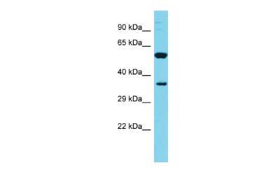 Western Blot: FAM49A Antibody [NBP2-82711]