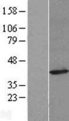 Western Blot: FAM49A Overexpression Lysate [NBL1-10535]