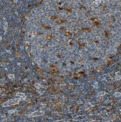 Immunohistochemistry-Paraffin: FAM49B Antibody [NBP1-88582]