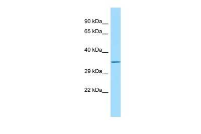 Western Blot: FAM49B Antibody [NBP2-82713]