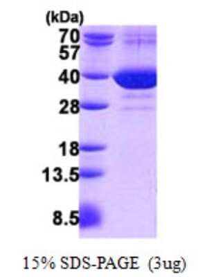 SDS-PAGE: Recombinant Human FAM49B His Protein [NBP2-23034]