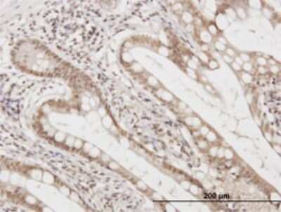 Immunohistochemistry-Paraffin: FAM50A Antibody (5F10) [H00009130-M02]