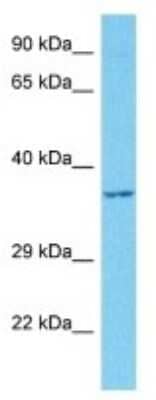 Western Blot: FAM50A Antibody [NBP3-10089]