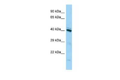 Western Blot: FAM50A Antibody [NBP3-10708]