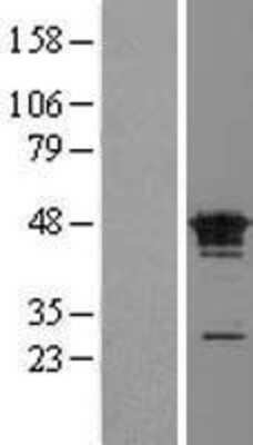 Western Blot: FAM50A Overexpression Lysate [NBL1-10537]